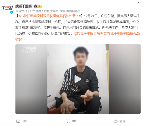 九游体育app娱乐不良饮食习尚不错说是痛风“重灾地”-九游「中国」jiuyou·官方网站-登录入口